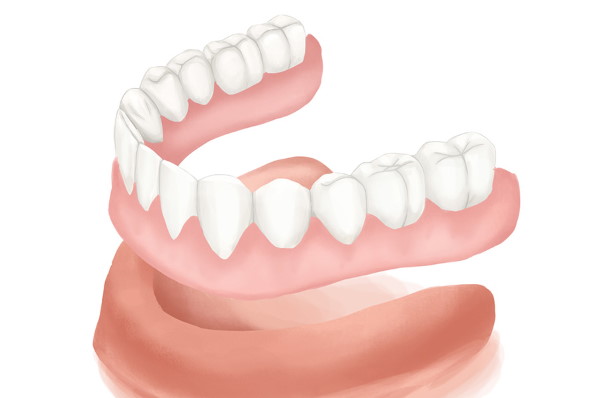 https://medventuremexico.com/wp-content/uploads/2025/02/dentures.jpg