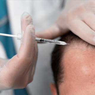 hair transplant banner hair transplant banner