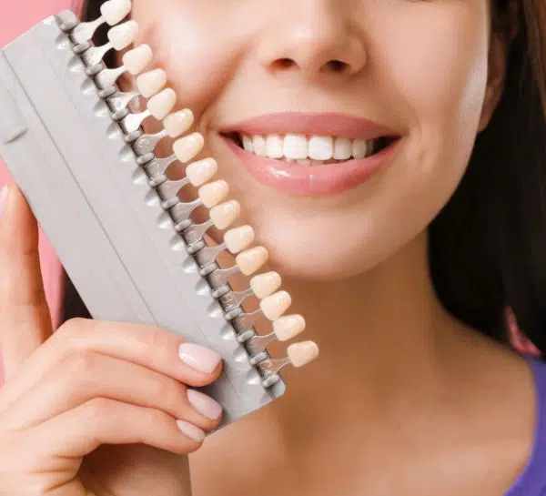 veneers2 veneers2